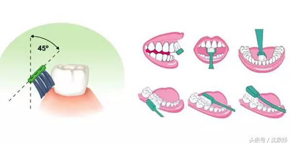 每天刷牙牙齿还黄?学会这些是美白牙齿的关键