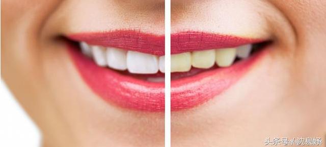 每天刷牙牙齿还黄?学会这些是美白牙齿的关键