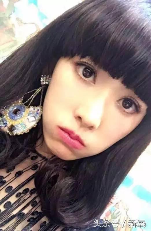 小s脸肿原因,小s脸怎么越来越肿