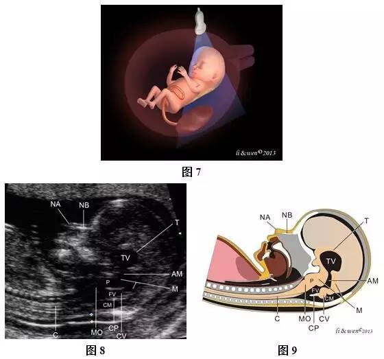 孕26周进行胎儿超声心动图检查,孕11-14周胎儿超声检测报告