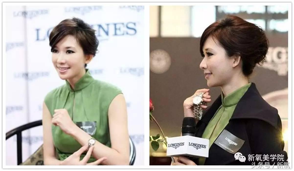 小s脸肿原因,小s脸怎么越来越肿