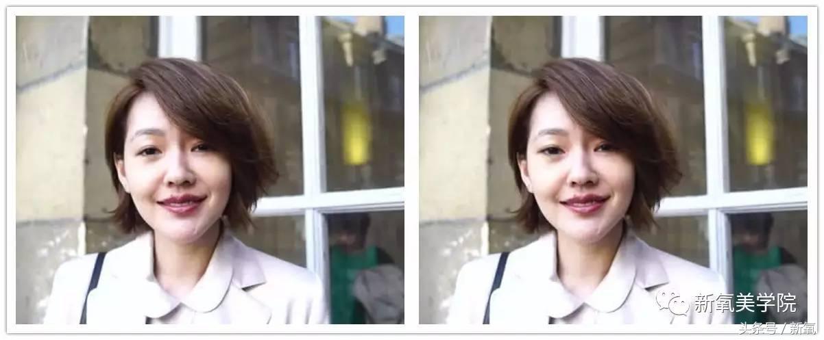 小s脸肿原因,小s脸怎么越来越肿