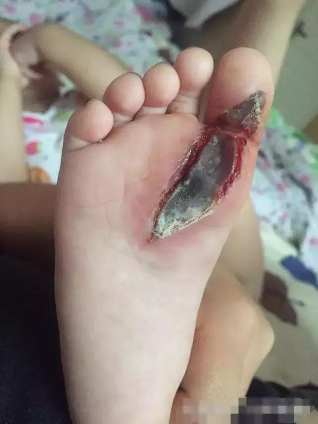 家有宝宝的时刻注意孩子的牙齿,家有宝宝的家长请注意