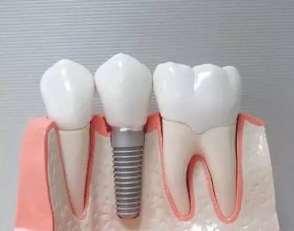 牙齿缺失不补会导致什么后果动画,牙齿缺失后不处理牙龈会萎缩吗