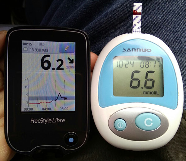 雅培瞬感血糖多久最准确,雅培动态血糖结果解读