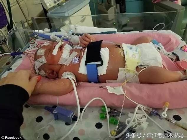 亲吻宝宝可能致病,亲吻宝宝的危害案例图片