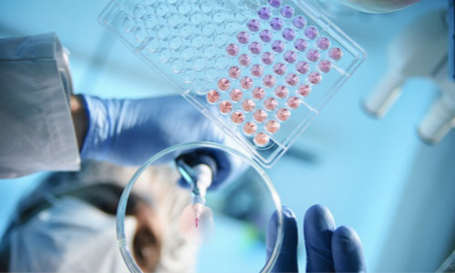 肾病患者吃了激素跟没吃一样，这是怎么回事？