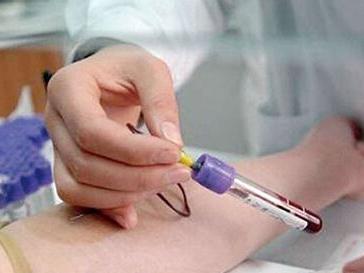 血hcg检查怀孕医生会通知吗,血HCG检查是怎么查的