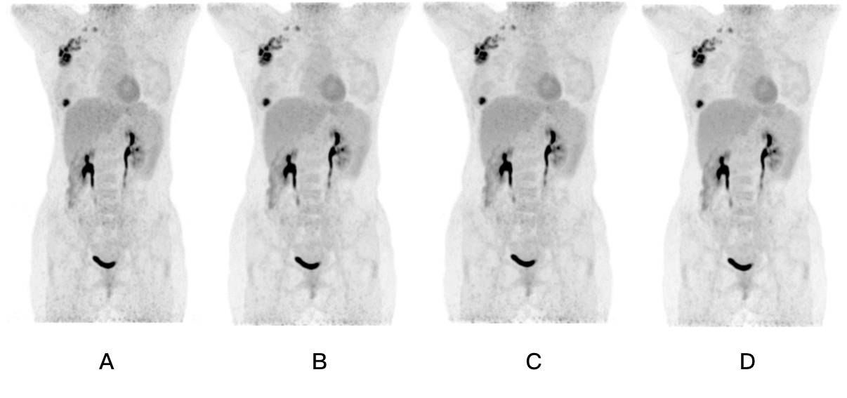 众大咖赴丹佛“掘金”，世界级宝藏“CreatedinChina”?！