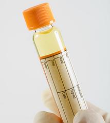 尿泡多就一定是蛋白尿吗,一泡尿从黄到清正常吗