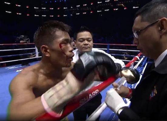 邹市明2017卫冕金腰带视频,邹市明职业拳坛冲击金腰带全纪录