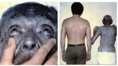 保健品隐藏真相揭秘,曾经火爆神坛的保健品