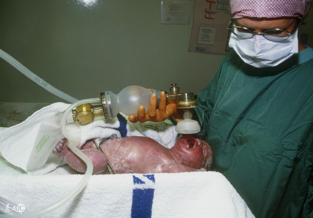 医生说我胎盘低有顺转剖的风险,帆状胎盘顺转剖来得及吗