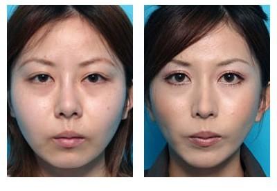 秒变小v脸就要坚持3个瘦脸小习惯,v型脸变胖了怎么办