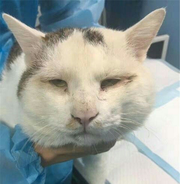 三角眼割双眼皮后效果,男生内双割双眼皮效果