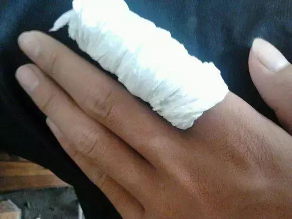 指甲根部被挫伤了怎么办,有一种痛叫做痛彻心扉