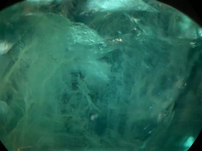 我的前半生宝石原石,我的前半生原石图片