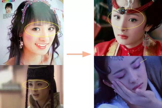 杨幂眼皮松弛怎么补救的,杨幂眼睛肿了怎么回事