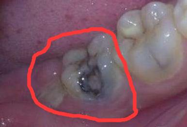 娌荤枟鐗欓緢鑲跨棝鐨勪腑鑽潗,鏇跨鍞戞不鐤楃墮榫堣偪鐥涘悧