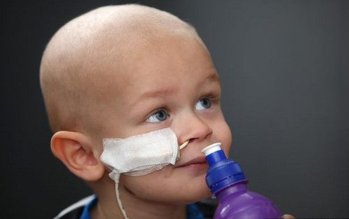 姜黄素抗癌研究报告,姜黄素能抗癌症吗