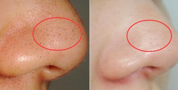 城野医生毛孔收敛水好吗,城野医生毛孔收敛水真有用吗