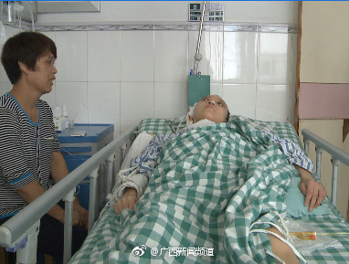 微创介入动脉瘤栓塞手术,脑部介入栓塞手术安全系数高吗