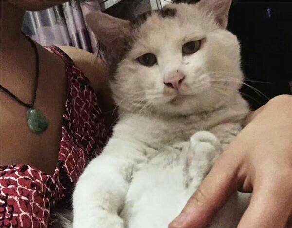 三角眼割双眼皮后效果,男生内双割双眼皮效果