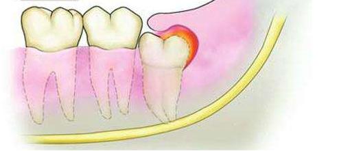 娌荤枟鐗欓緢鑲跨棝鐨勪腑鑽潗,鏇跨鍞戞不鐤楃墮榫堣偪鐥涘悧
