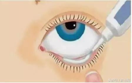 滴眼液日常用,正确使用滴眼液的注意事项