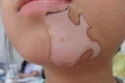 白癜风治疗出现瓶颈，多位白癜风专家“三顾茅庐”请出老中医，与其一起研究白癜风的治疗方法，成果惊人