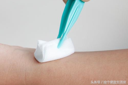 生活中烫伤应该如何自救,生活中的烫伤