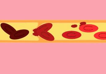 心梗直播间,心梗发病全过程视频