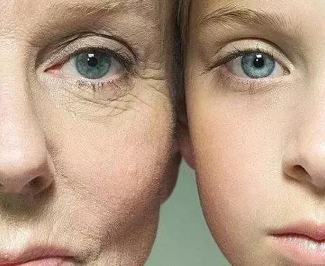 用了眼霜之后长脂肪粒怎么消除,眼霜用了长脂肪粒怎么消除