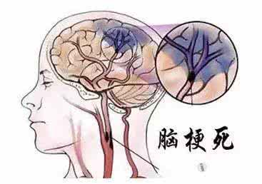 同仁牛黄清心丸功效与作用及价格,同仁牛黄清心丸有哪些成分组成