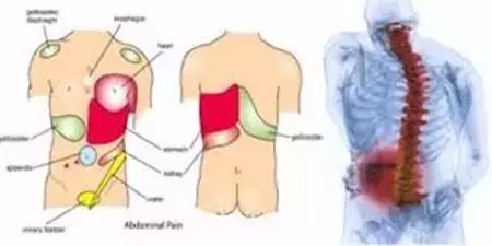 治疗腰疼的运动,治疗腰痛只需一个动作