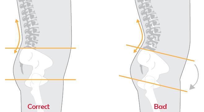 上交叉综合征及其康复训练,下交叉综合征训练方法