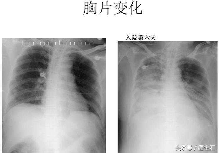 医生可以救多少病,医生要救人吗