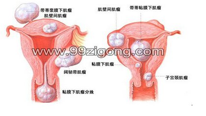 宫腔镜科普小知识视频,宫腔镜科普知识现场讲解比赛