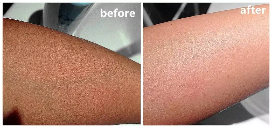 全球顶级脱毛膏,一款很牛的脱毛膏