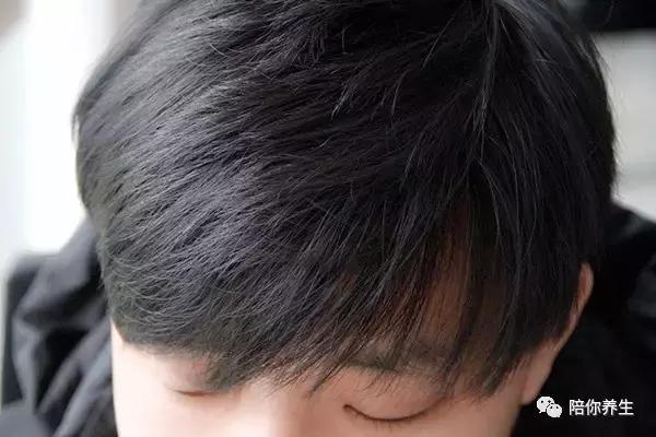 头发少秃顶适合什么发型,头顶头发稀少怎么办剃光头