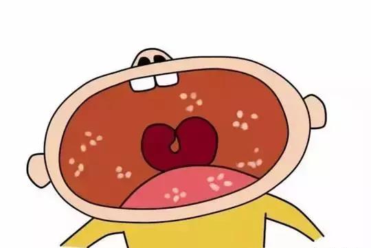 宝宝鹅口疮月嫂奶具消毒不到位吗,月嫂小儿护理