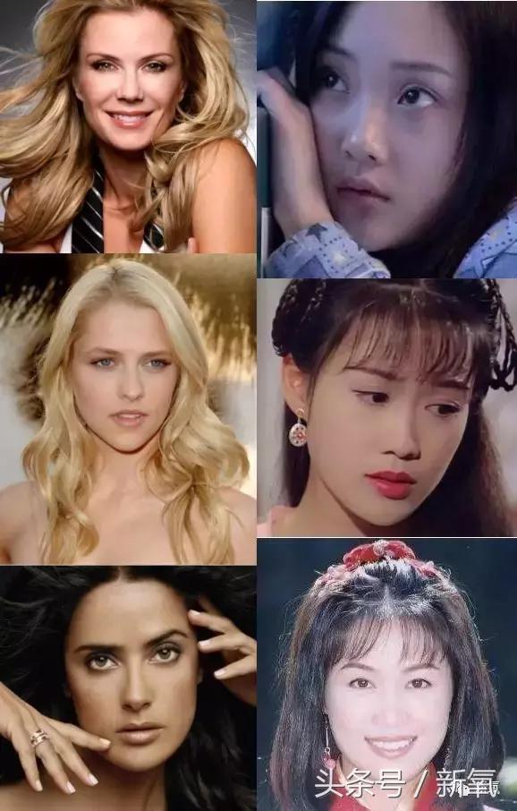 做了个达拉斯隆鼻,假体直接戳到脑门,我是不是和张檬、刘雨欣遇到了同一个医生!