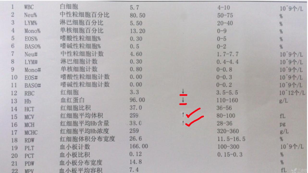 血常规报告单数据可以看出贫血,地中海贫血的血常规报告单怎么看