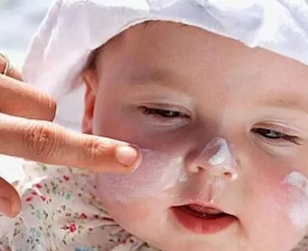 3招区别白色糠疹和白癜风,三种不容易治疗的白癜风类型