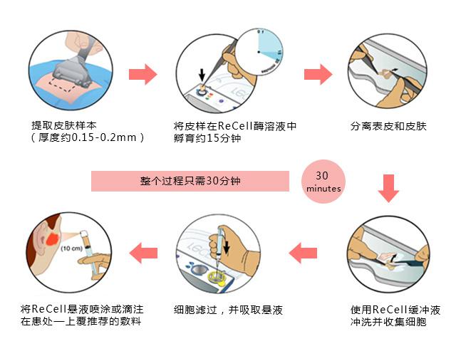 国际目前最有效的治疗白癜风,中国治疗白癜风顶级专家