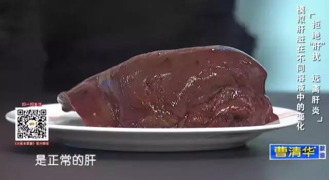 每天饮酒500ml算多吗,每天饮酒酒精量