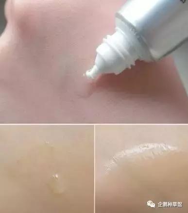 有没有永远不长痘的办法,有没有办法永远不长痘