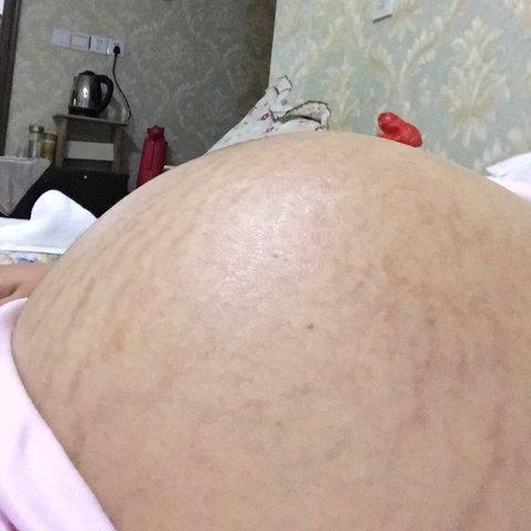 年轻准妈妈死活不肯顺产，原因令人尴尬不已！