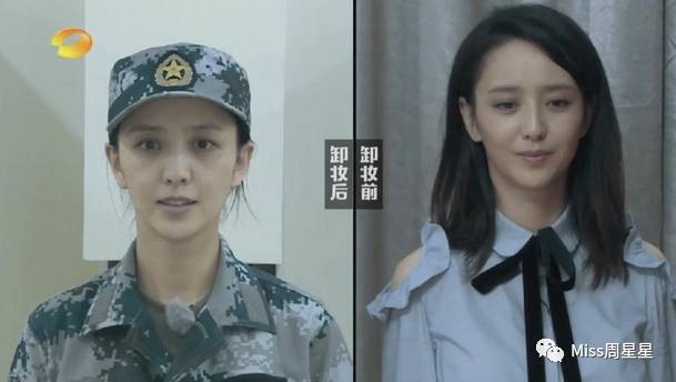 严重黑眼圈的治愈经历,千年黑眼圈解决方案