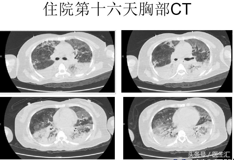 医生可以救多少病,医生要救人吗